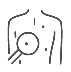 Skin Cancer Treatment